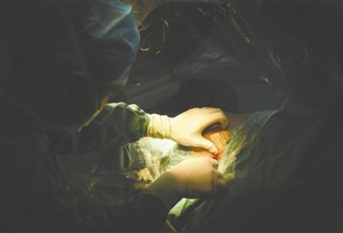 成都首个骨科手术机器人在成都大学附属医院“上岗” 手术费用大降
